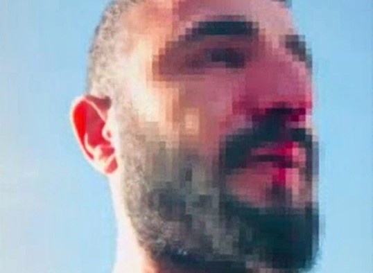 Dicle Elektrik Ekibine Siirt’te Saldırı: 2 Yaralı