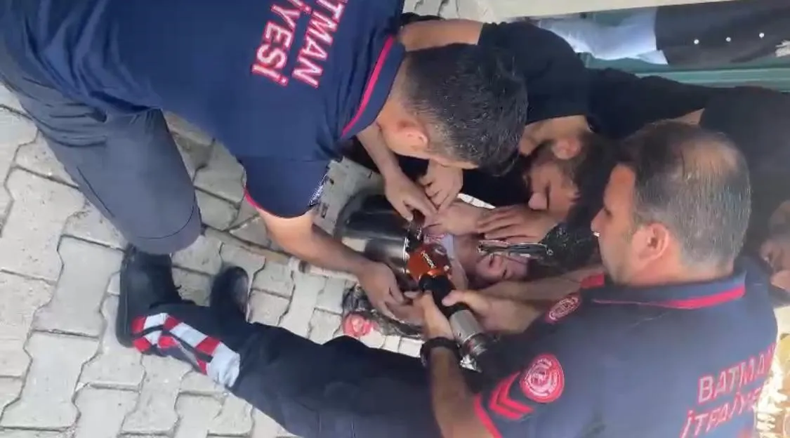 2 Yaşındaki Çocuk Oyun Oynarken Düdüklü Tencerede Sıkıştı