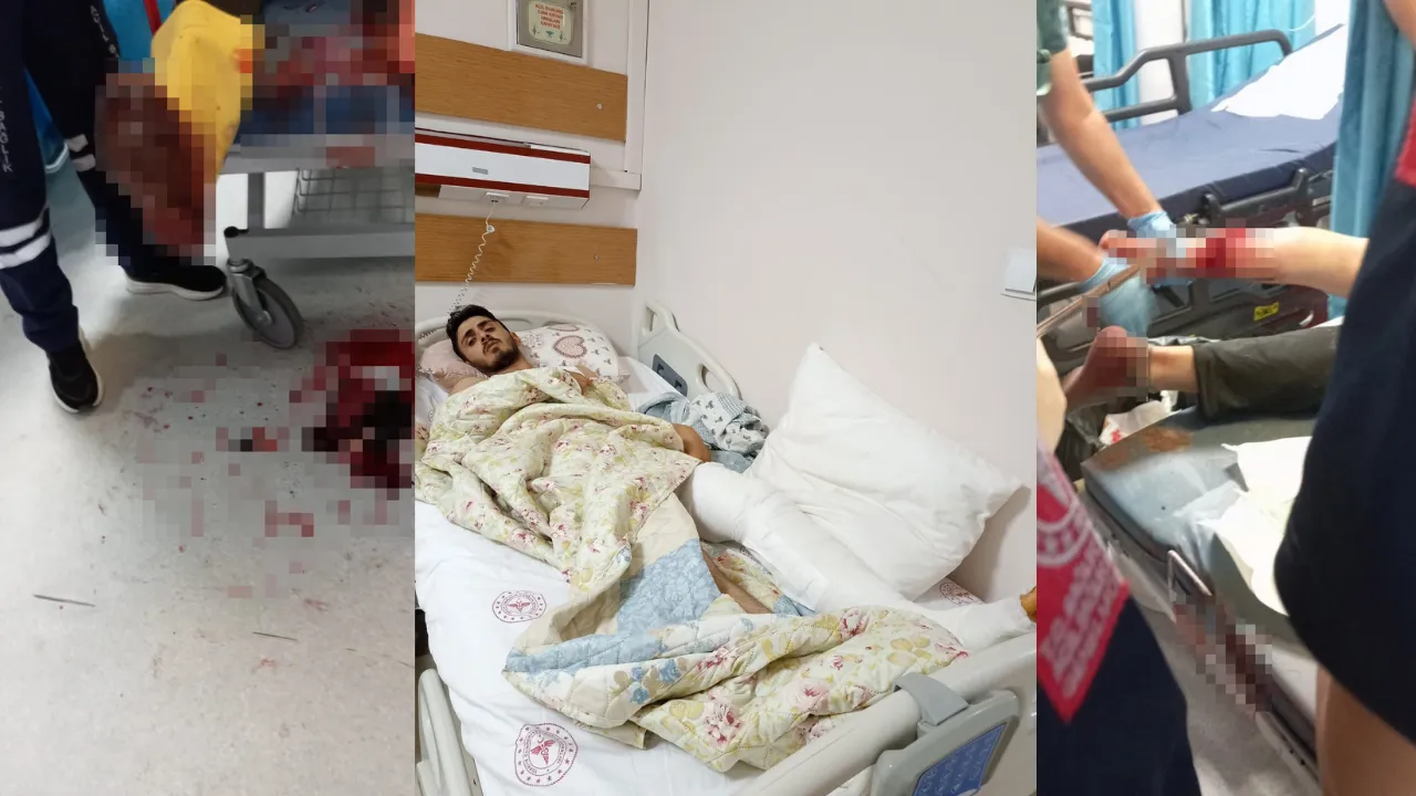 Domuzların Saldırısına Uğrayan Vatandaş Yaralandı