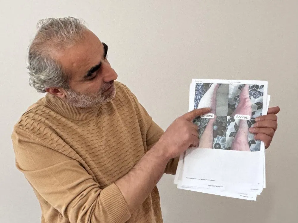 Jeoloji Mühendisi Sedef, Egzama, Uyuz ve Vitiligo İçin Krem Üretti
