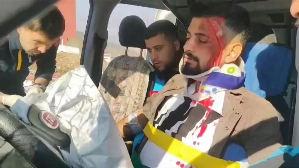 Siirt'te Fermuar Sistemi Uygulaması Anlatıldı